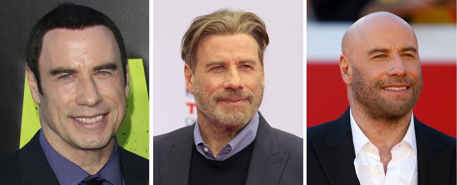 John Travolta's hair journey over the years