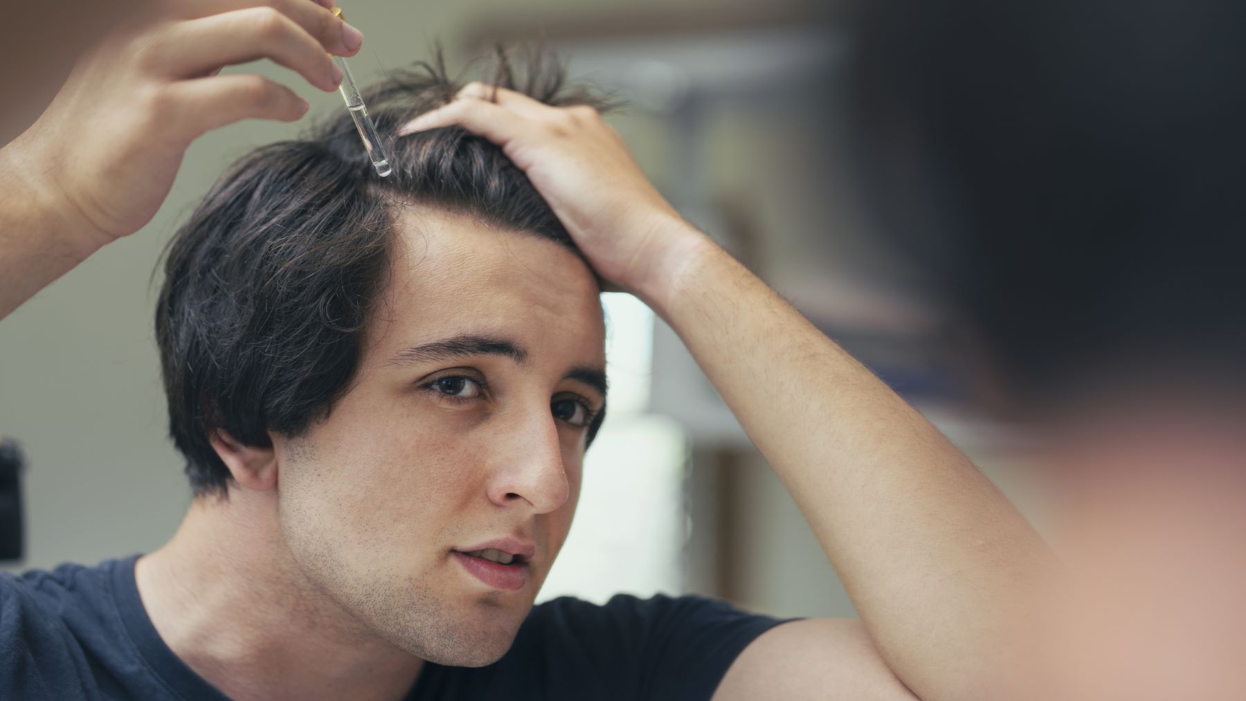 Man trying to prevent his hairline from receding