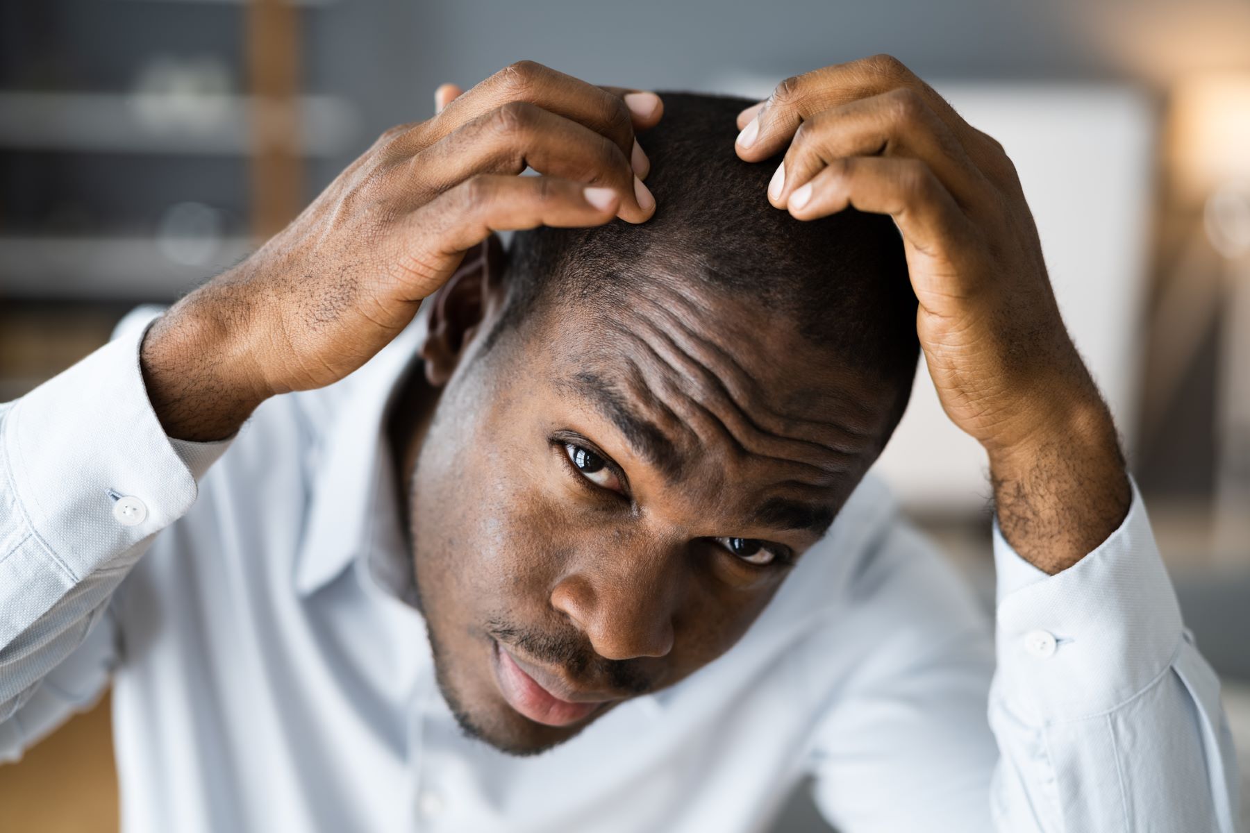 Man with receding hairline wondering if he is balding