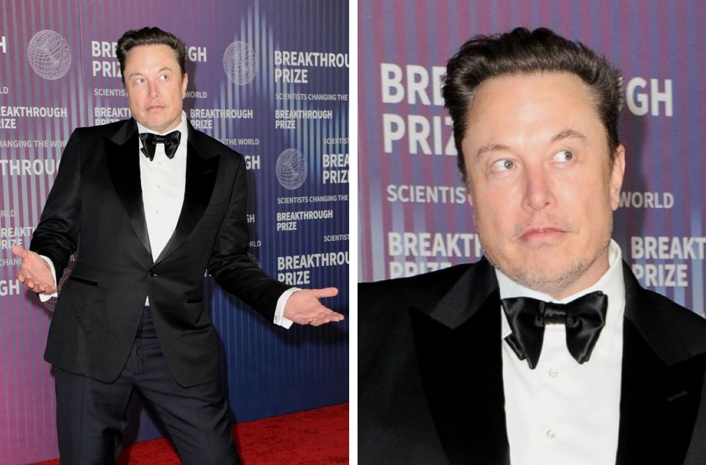 Elon Musk's hairline and full head of hair in 2024