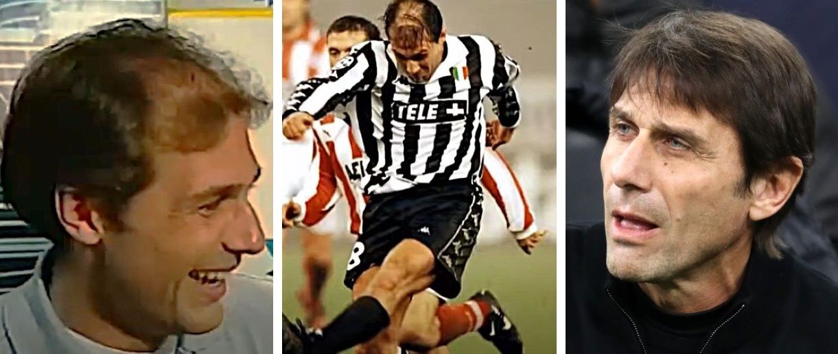 Antonio Conte's hair through the years