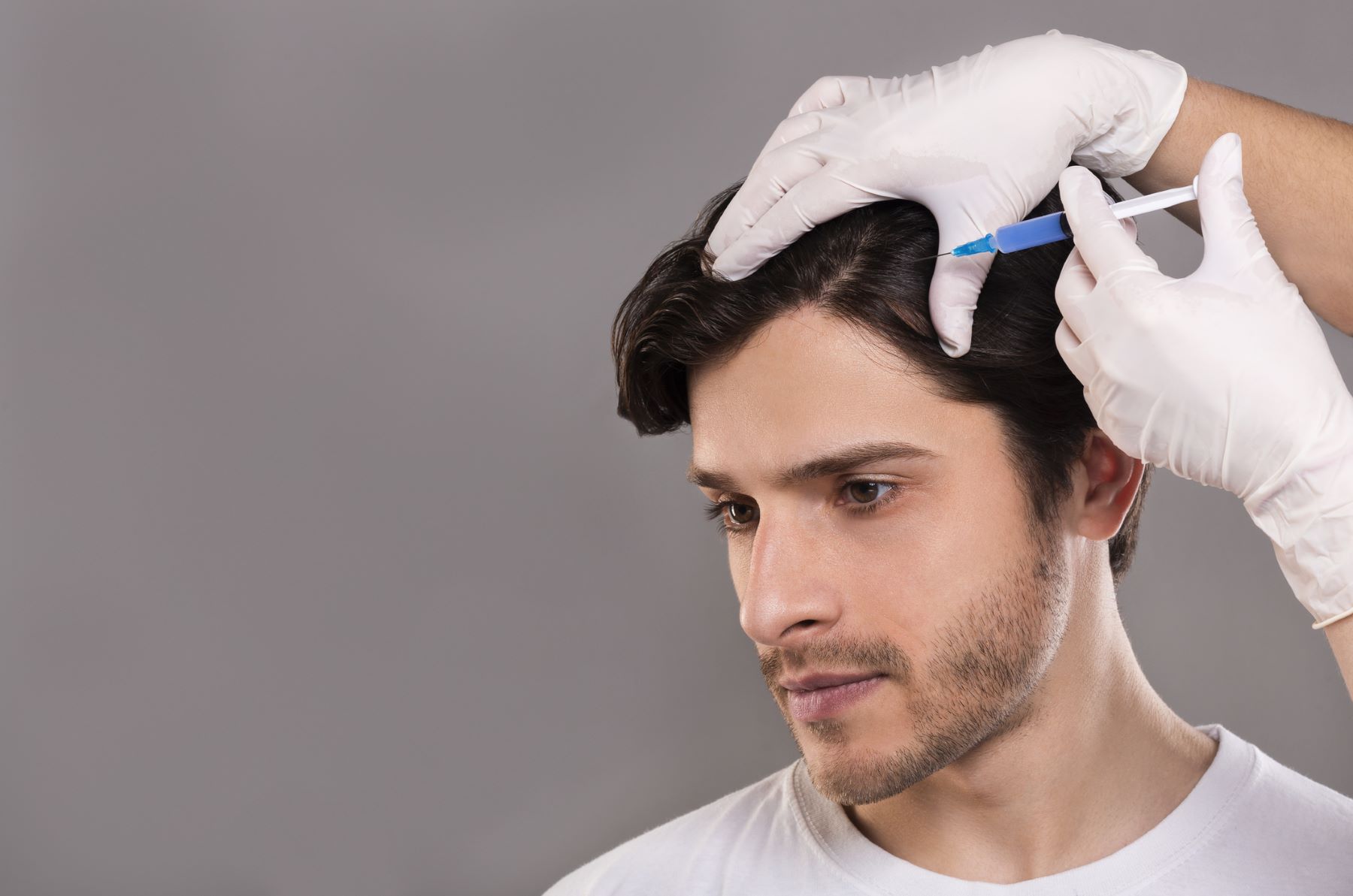 PRP hair treatment for hair loss on one side