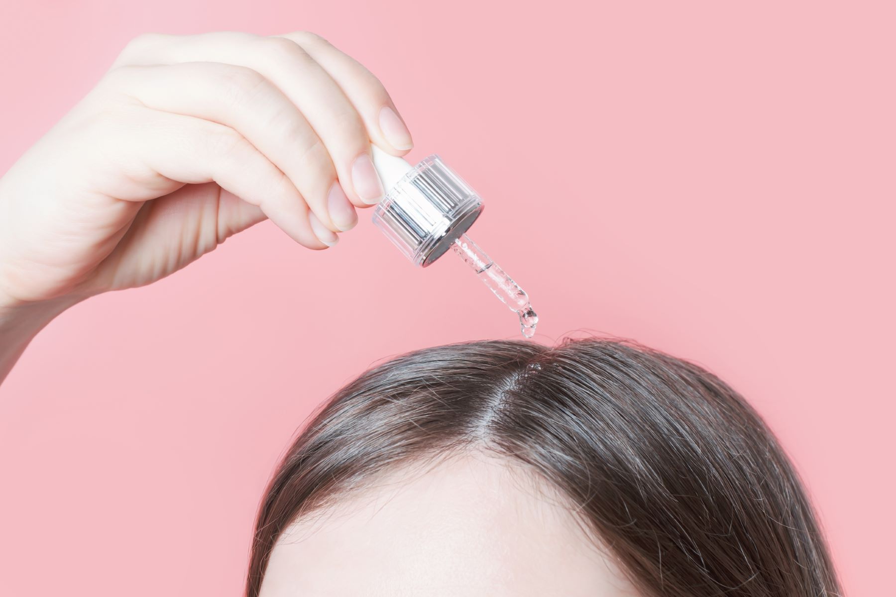 Woman using Minoxidil for her receding hairline