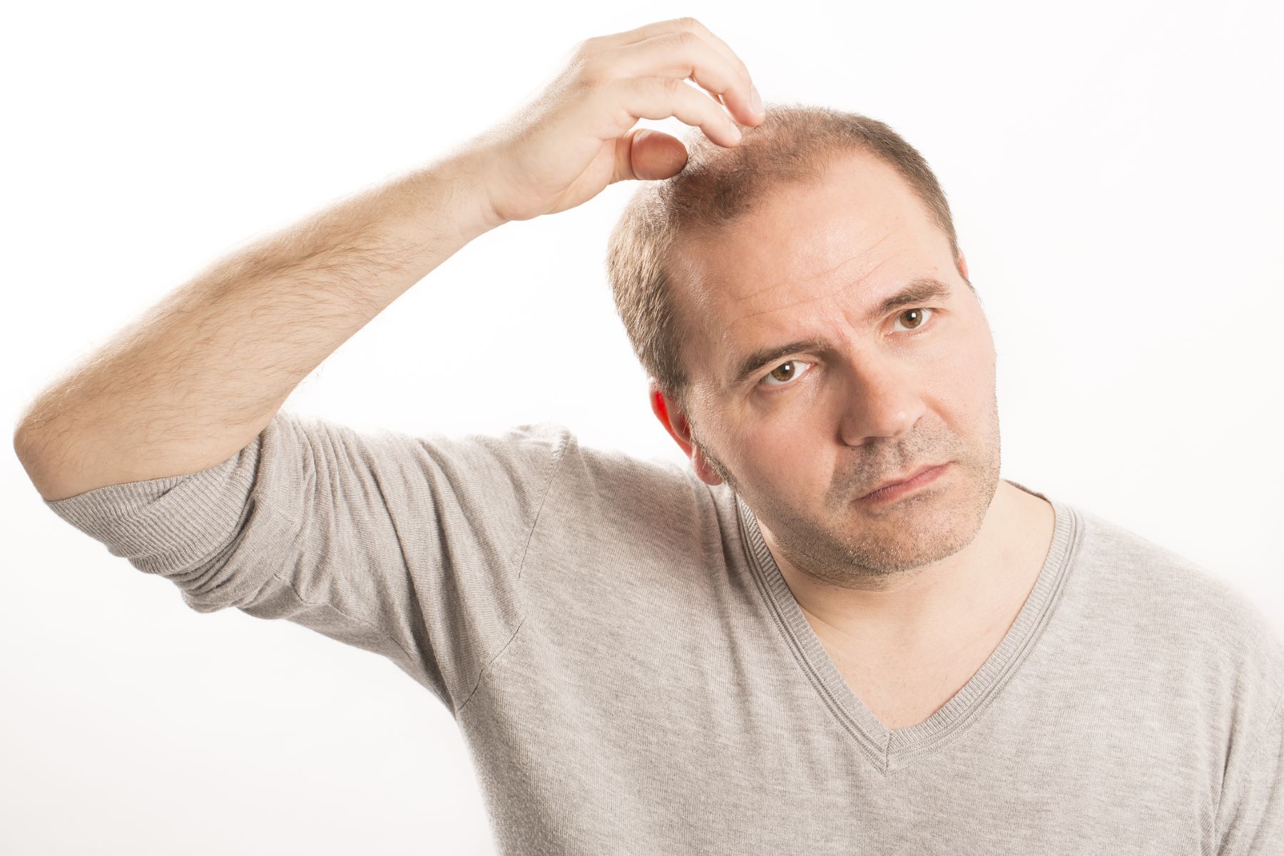 Man wondering about hair loss blood tests