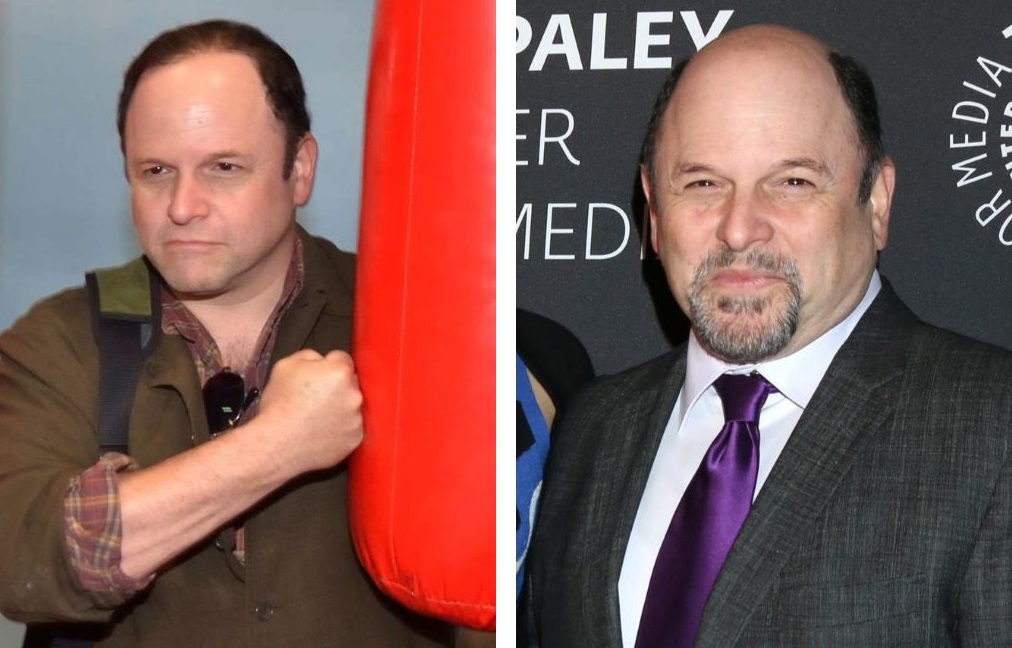 Jason Alexander with hair (left) and bald (right)