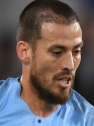 David Silva 6 months post hair transplant procedure