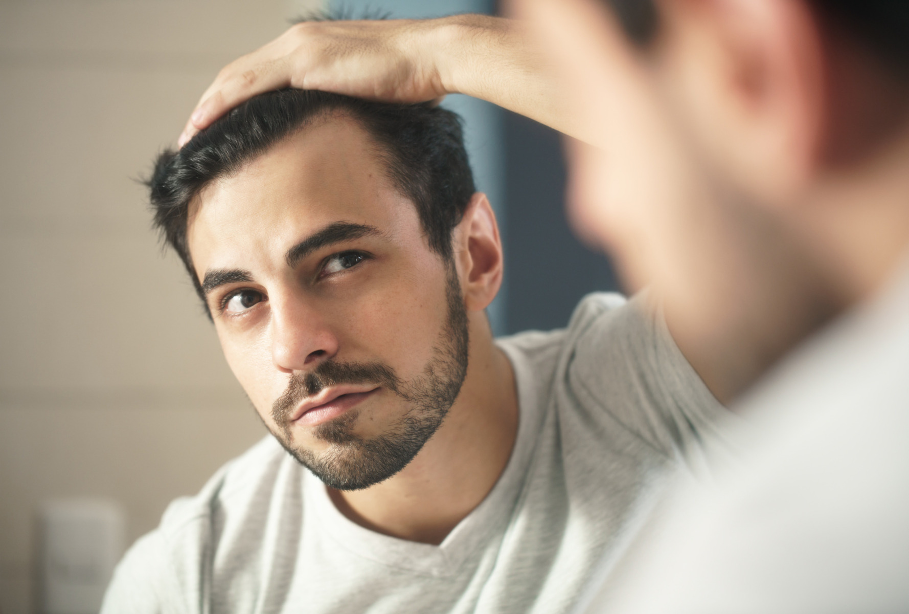 Is it normal to have a receding hairline at 20?