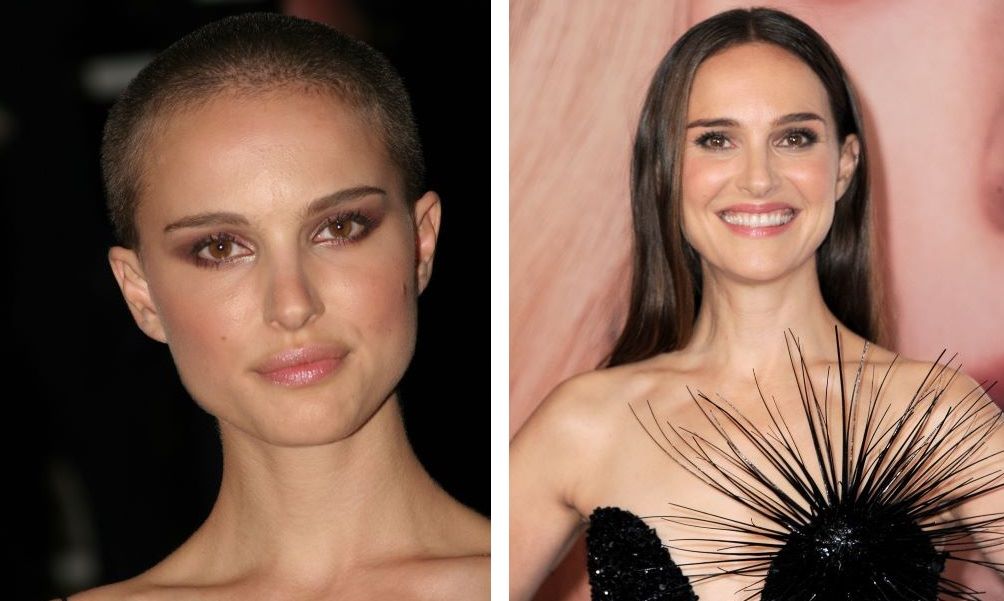 Natalie Portman with a shaved head (left) and with hair (right)