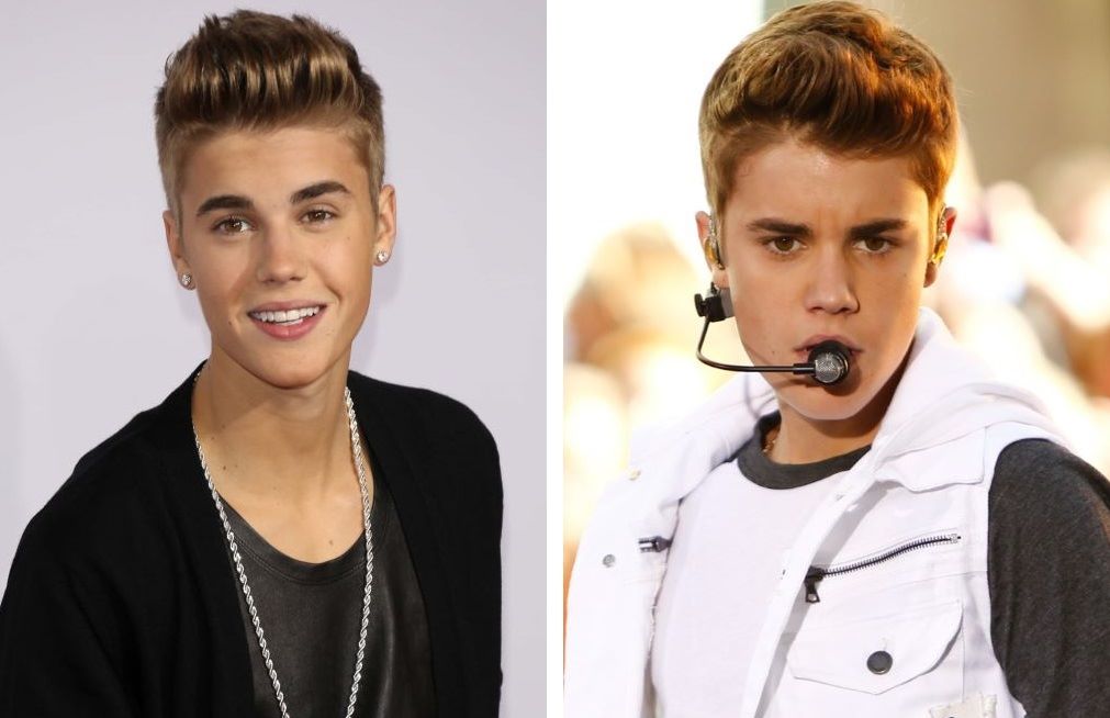 Justin Bieber’s hairline in 2012