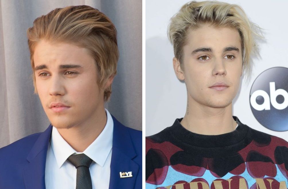 Justin Bieber's hairline in 2015