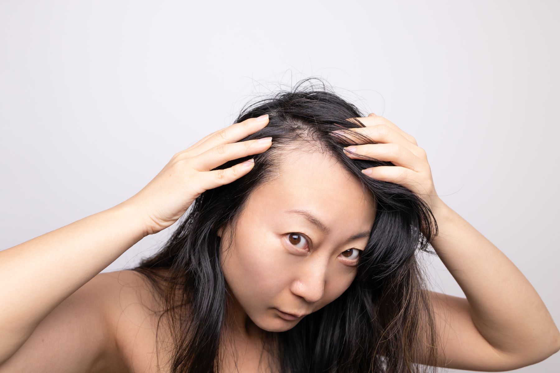 Woman wondering if her temple hair loss will grow back