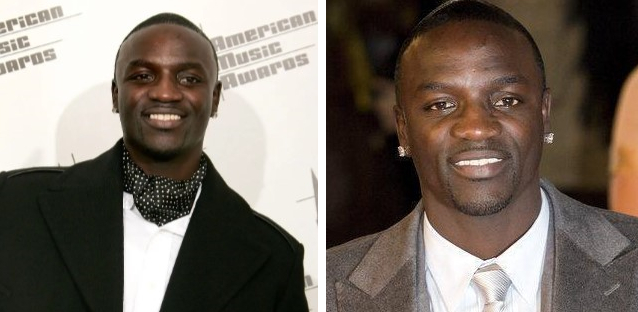 Akon's hairline in 2006 (left) and 2009 (right)