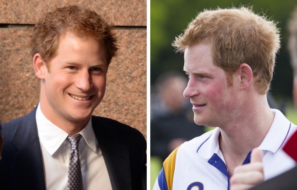 Prince Harry's hair in 2014