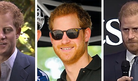 Prince Harry’s Hair Transplant - Everything You Need To Know