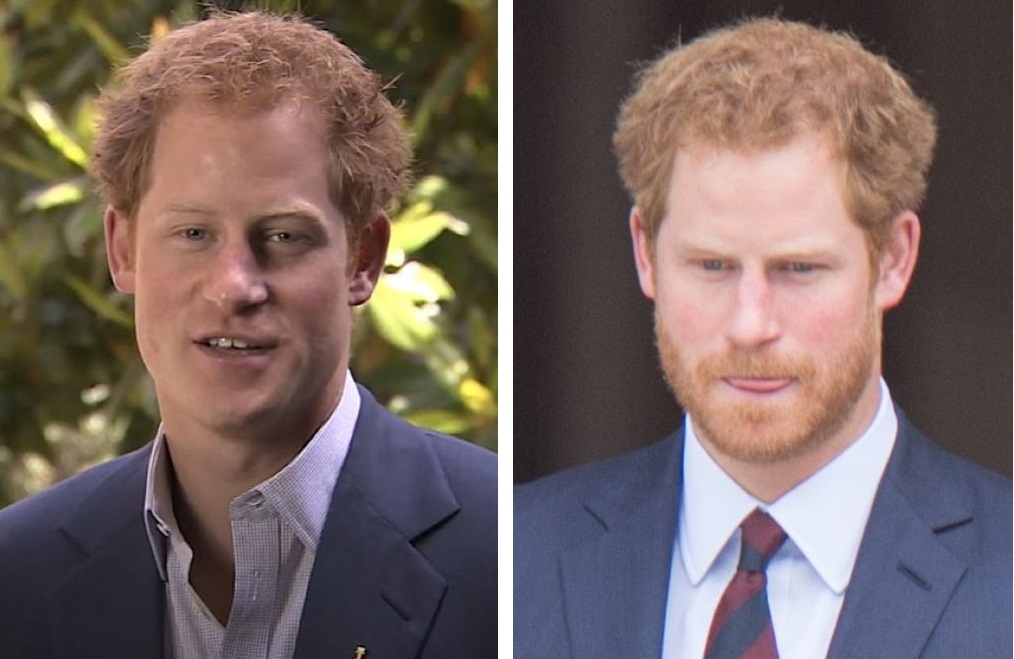 Prince Harry's m-shaped hairline in 2016