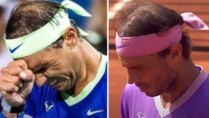 Rafael Nadal's thinning hair in 2021