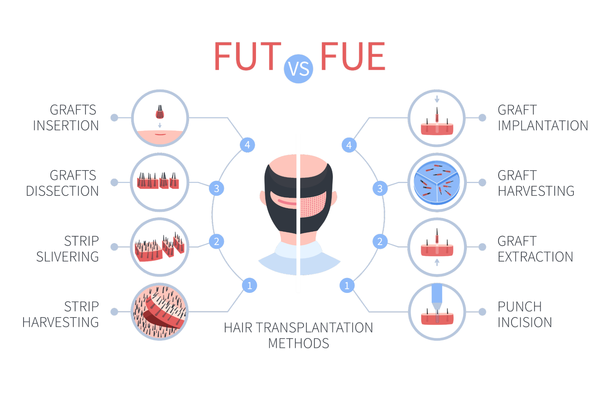 FUT vs FUE hair transplant