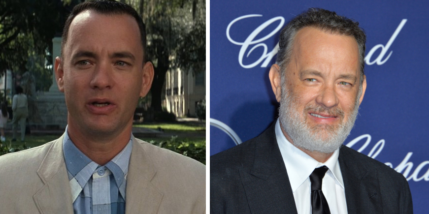 Tom Hanks’ Hair Transplant: Everything You Need To Know