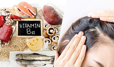 Does Vitamin B12 Deficiency Cause Hair Loss Or Is It A Myth?