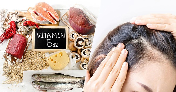 Does Vitamin B12 Deficiency Cause Hair Loss or Is It a Myth?