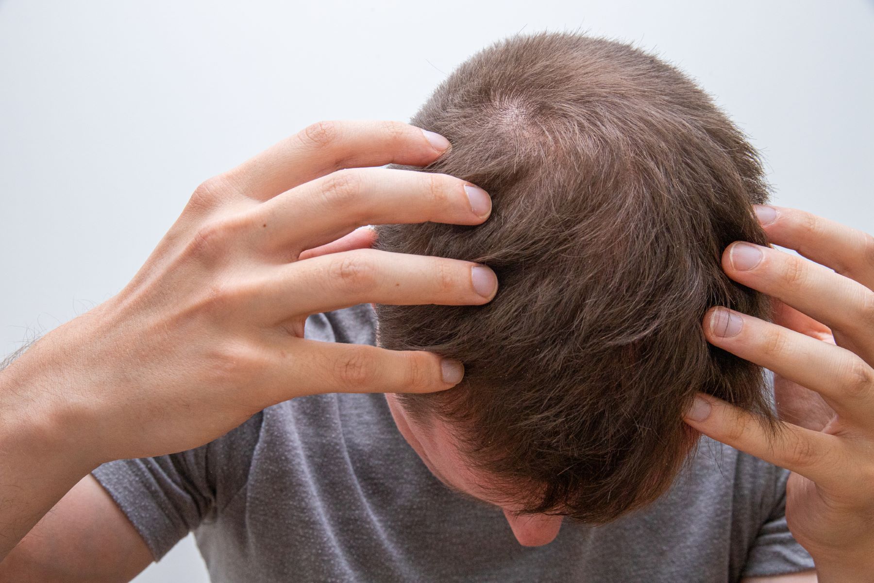 Man massaging his scalp to stimulate blood flow