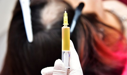 Steroid Injections For Hair Loss: Effectiveness, Risks & Benefits