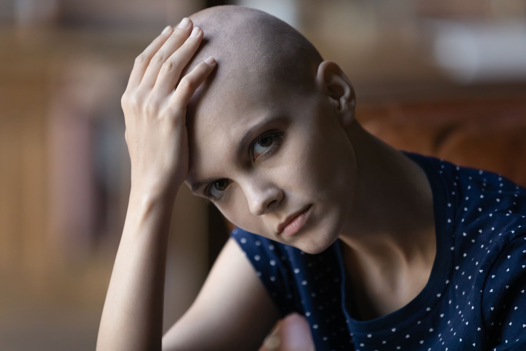 Young, beautiful bald woman