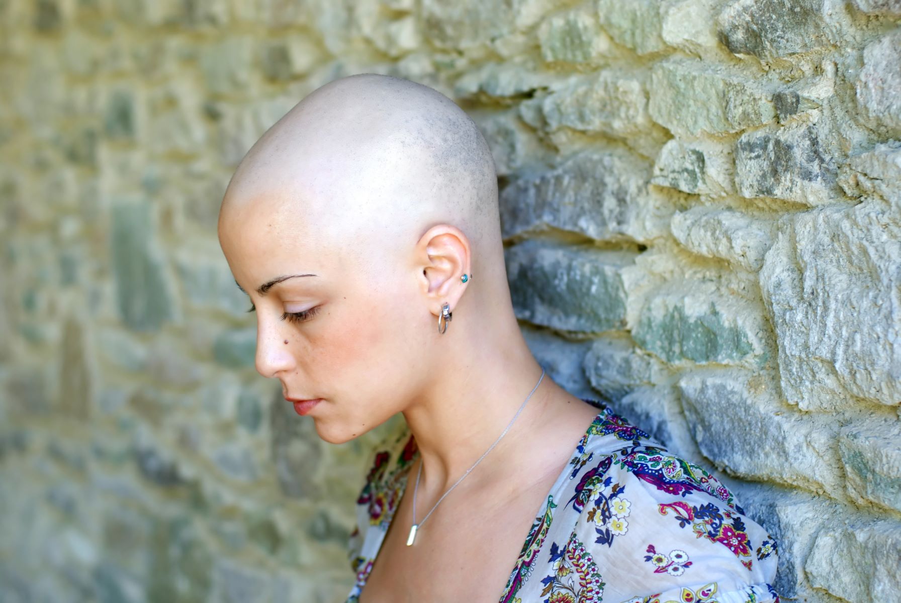 chemotherapy induced hair loss