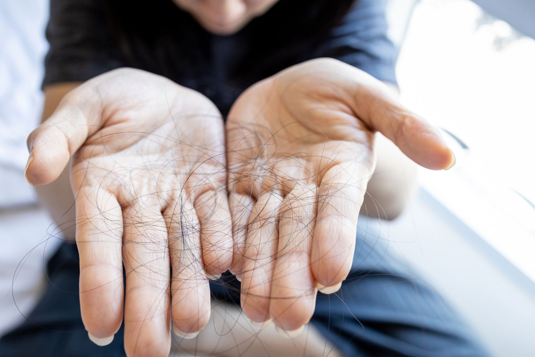 person showing lost hair strands in their hands