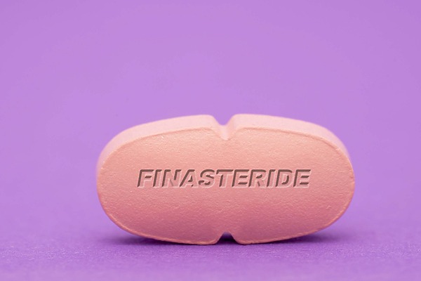 Are Finasteride Side Effects Permanent - Review