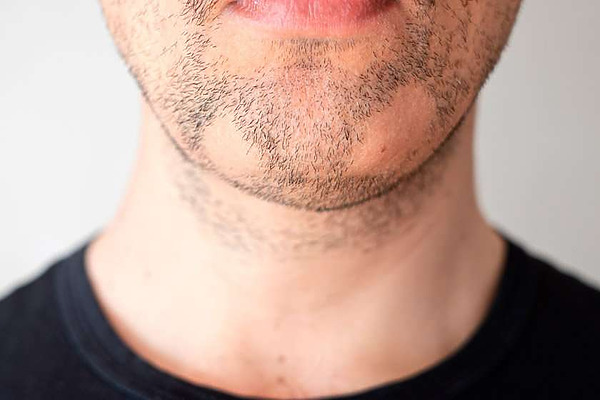 7 Reasons You May Be Growing A Patchy Beard And How To Fix It