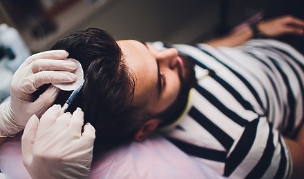 Does Getting PRP After A Hair Transplant Improve Its Results