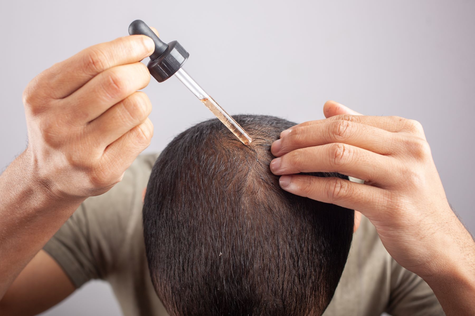 Man using a hair treatment on his crown