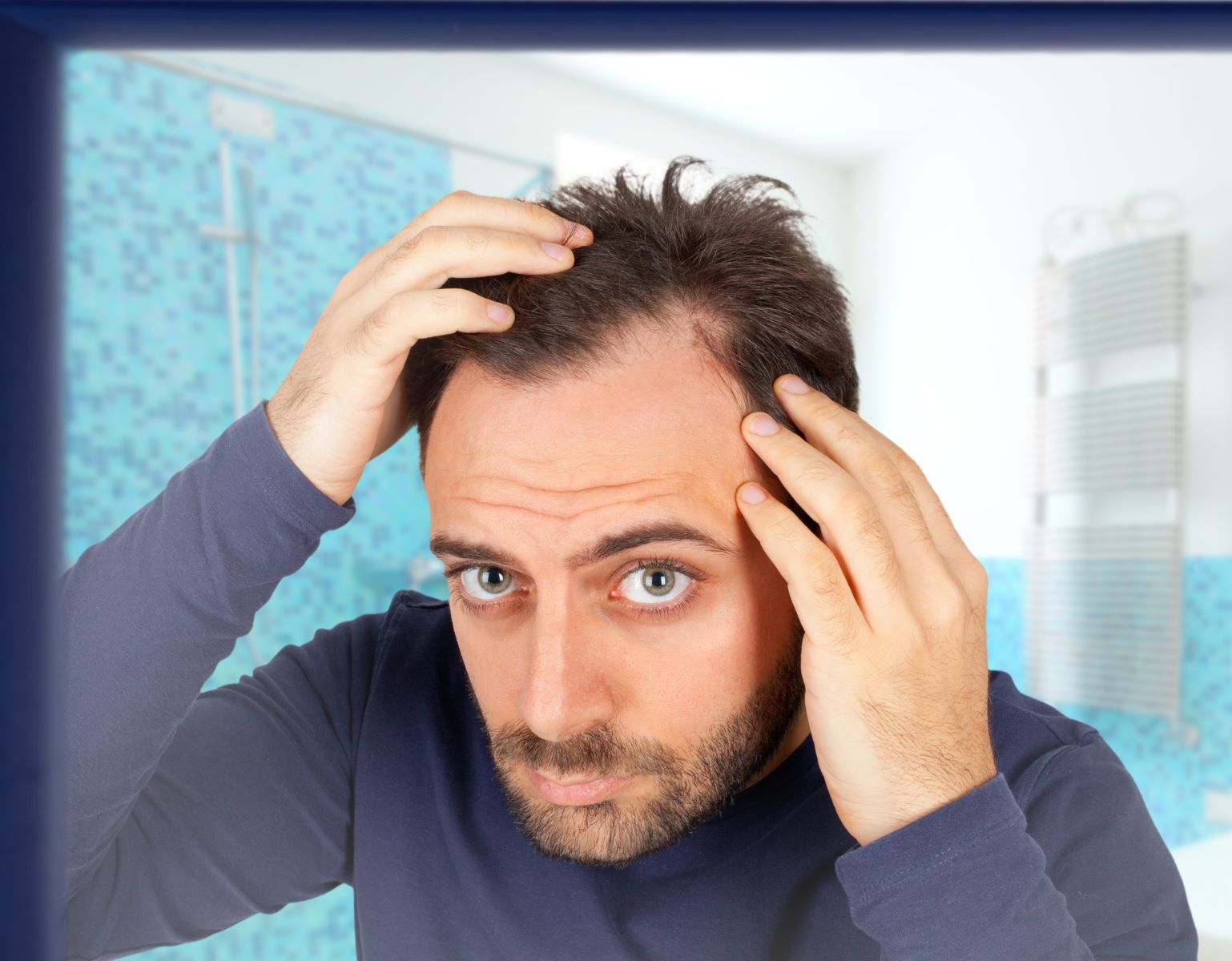 Man with male pattern baldness