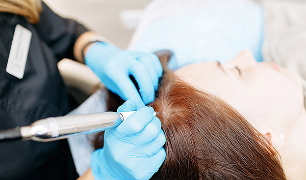 Woman getting scalp micropigmentation