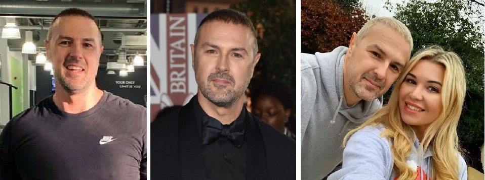 Paddy McGuinness’s rumoured hair transplant