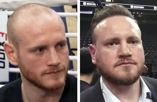 George Groves Hair Transplant