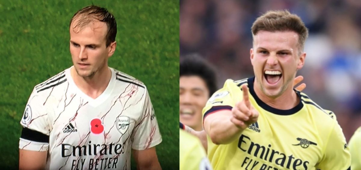 Rob Holding’s hair transplant after 11 months