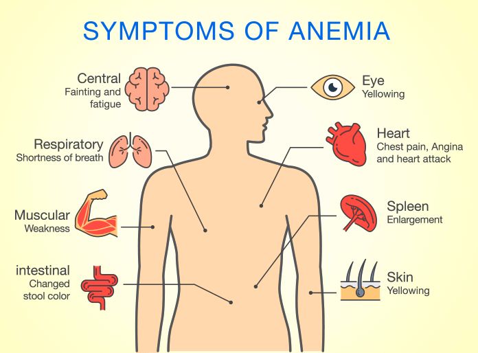 Symptoms of anaemia