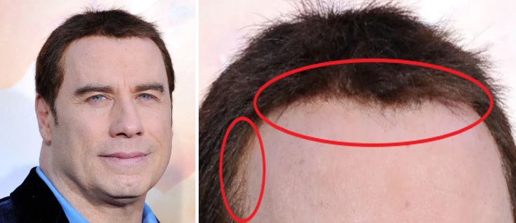 Travolta’s toupee edges visible in photo