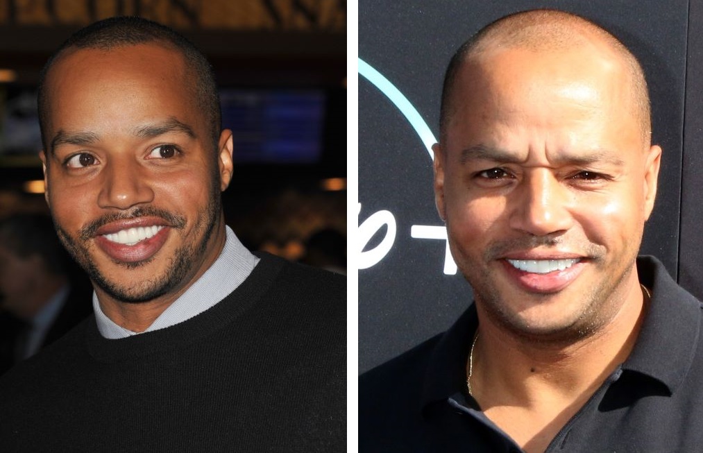 Donald Faison with hair (left) and bald (right)