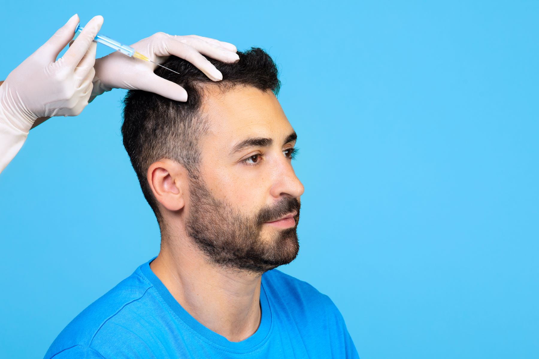 Are PRP Hair Treatment Side Effects a Risk Worth Taking?