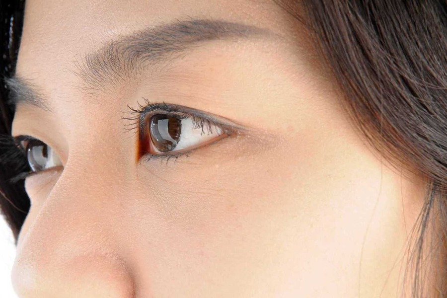 Thicker, Fuller Eyebrows Through Eyebrow Transplants