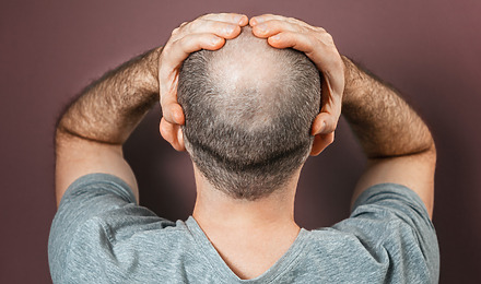 How To Regrow Hair On Bald Spot Fast