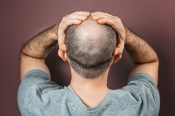 How To Regrow Hair On Bald Spot Fast