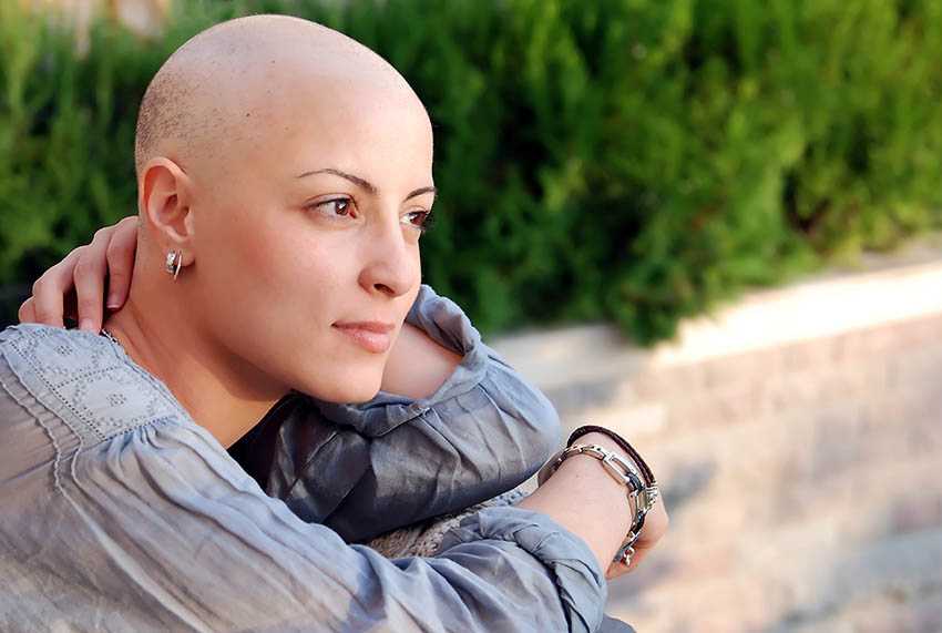 Chemotherapy-hair-loss-special-cancer