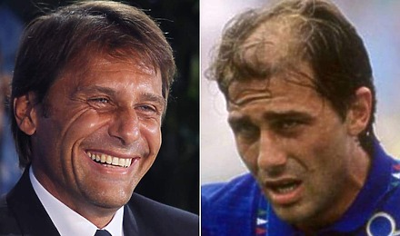 Antonio Conte Hair Transplant Featured Image