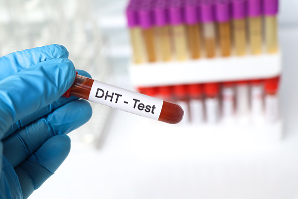 What is DHT & Its Role In Hair Loss? A Complete Overview