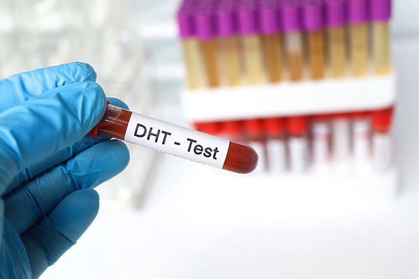 What Is DHT & Its Role In Hair Loss? A Complete Overview