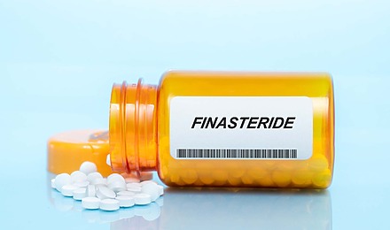 Can You Get Finasteride On The NHS?